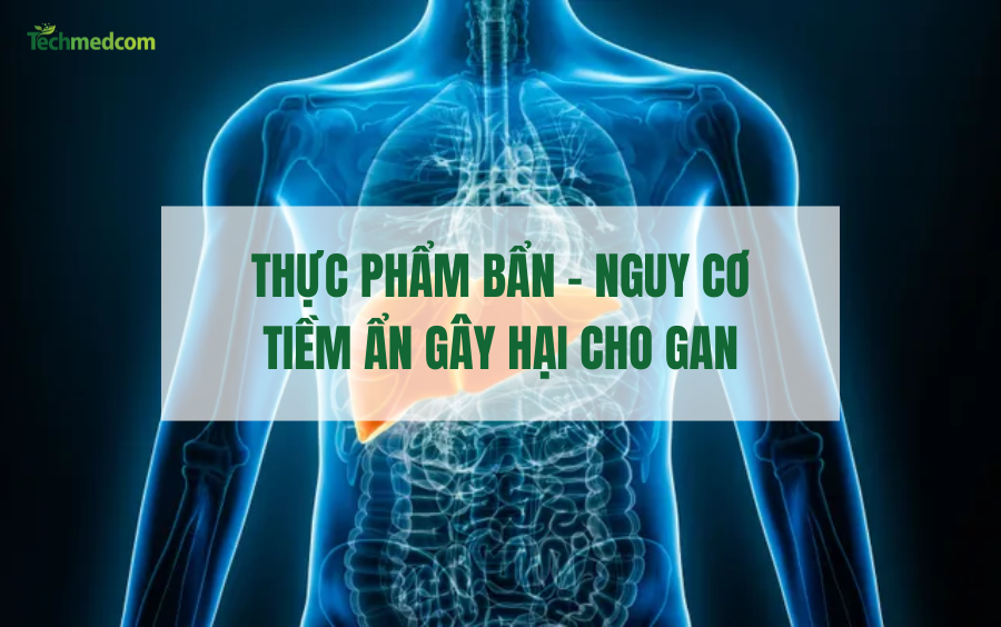 THỰC PHẨM BẨN – NGUY CƠ TIỀM ẨN GÂY HẠI CHO GAN